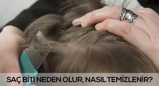 Saçta Bit Neden Olur? Parazitlerin Oluşumu, Bulaşma Yolları ve Belirtileri