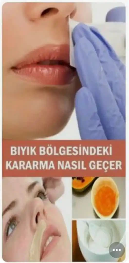 Yüzdeki Kararmalar ve Etkili Çözüm Yolları Cilt Sağlığını Koruma Rehberi