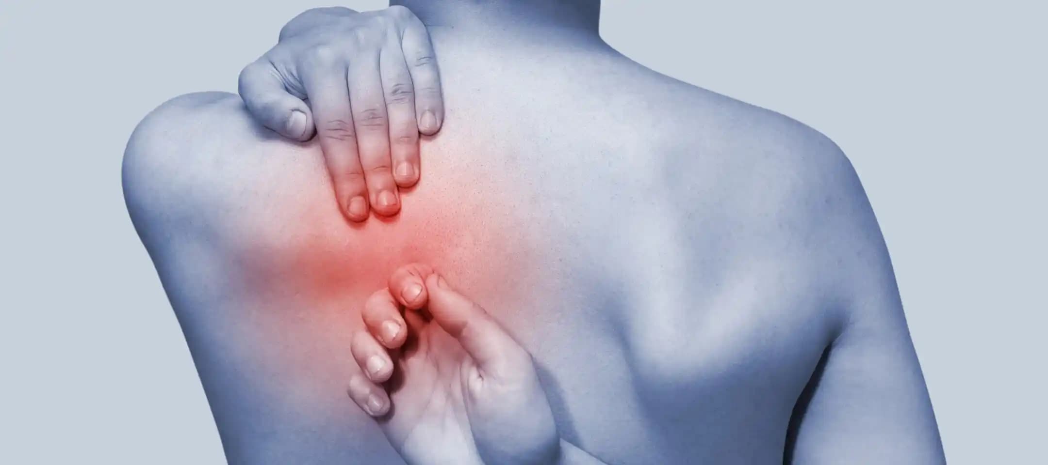 Sırt Aknesi Bakımı: Partneriniz İçin Etkili Dermatolojik ve Günlük Yaklaşımlar