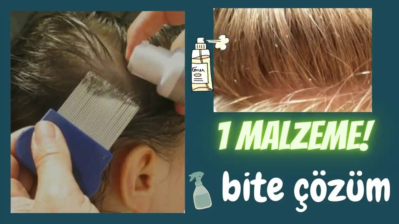 Bit Nasıl Gider: Etkili Tedavi Yöntemleri ve Korunma Stratejileri Rehberi